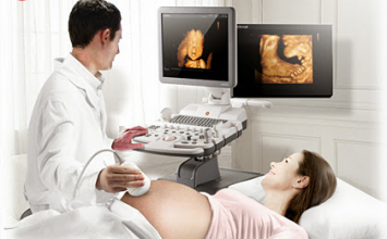 siêu âm 4d, bà bầu, thia nhi, thai ngoài tử cung