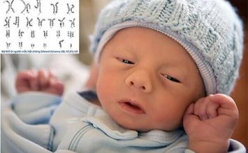Những dị tật thai nhi thường phát hiện qua siêu âm