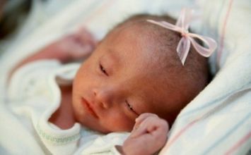 Những điều cần biết về hội chứng Edwards
