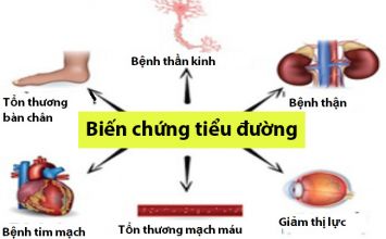 biến chứng bệnh tiểu đường