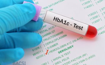 xét nghiệm HbA1c