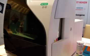 lựa chọn máy xét nghiệm HbA1c