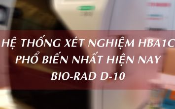 hệ thống xét nghiệm HbA1c 
