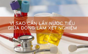 vì sao cần lấy nước tiểu giữa dòng