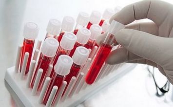 xét nghiệm huyết học