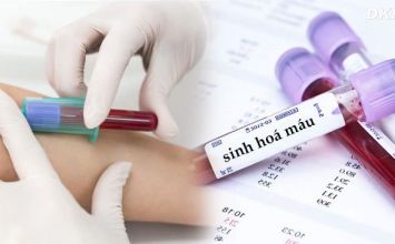 xét nghiệm sinh hoá máu - phần 2