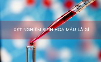 xét nghiệm sinh hoá máu là gì