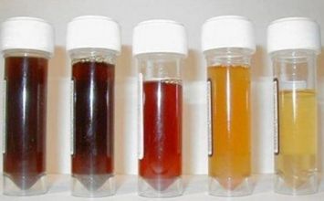 màu sắc nước tiểu