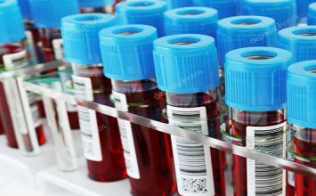 xét nghiệm tổng phân tích tế bào máu