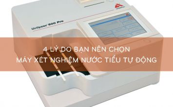 chọn máy xét nghiệm nước tiểu