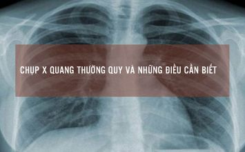 x quang thường quy