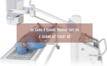 x quang kỹ thuật số