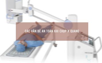 chụp x quang