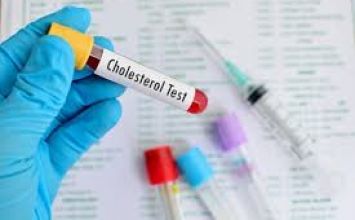 Mức độ Cholesterol bình thường cho từng độ tuổi