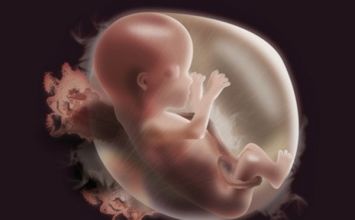 Dị tật ống thần kinh ở thai nhi
