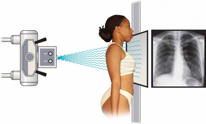 nguyên lý hoạt động của máy chụp x quang