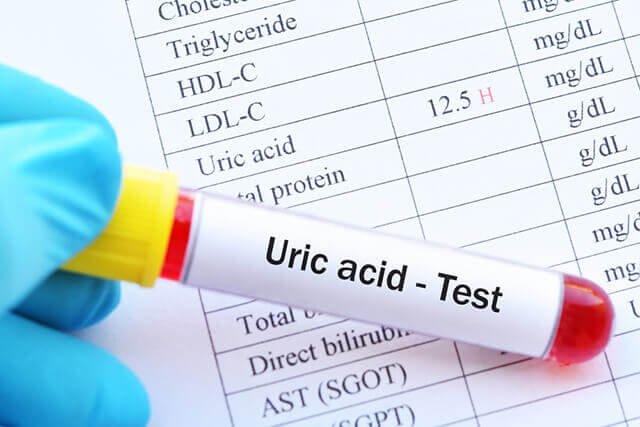 chỉ số acid uric bình thường là bao nhiêu