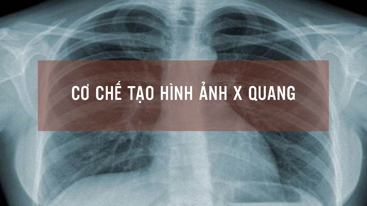 108 huyệt đạo trên cơ thể trị bệnh đầy đủ nhất Kèm hình ảnh