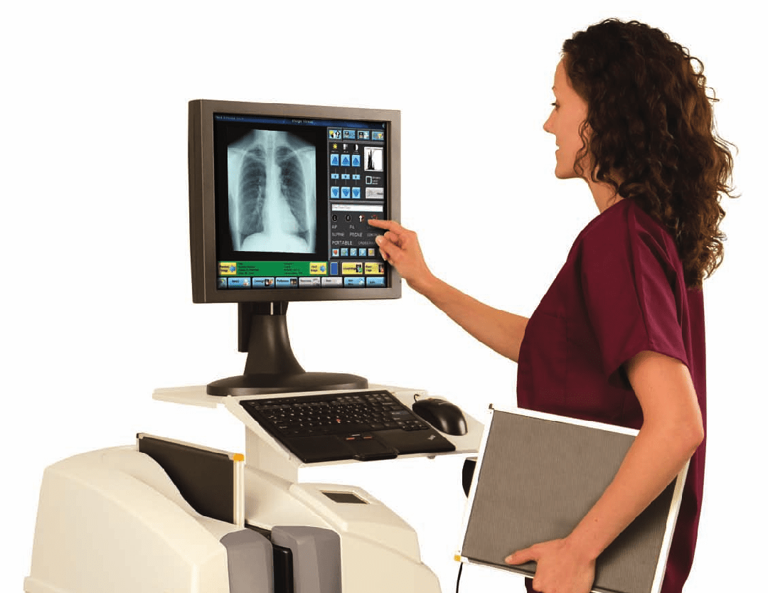 hệ thông số hóa X-quang
