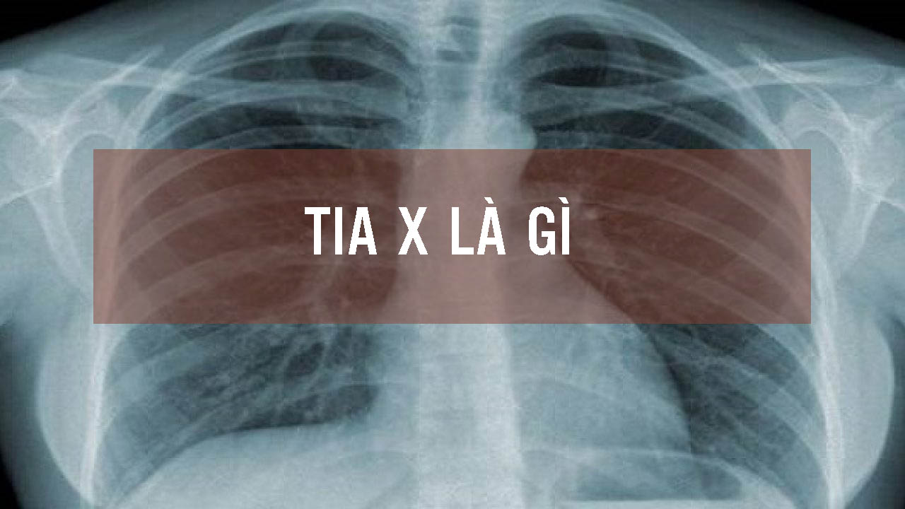 tia x là gì?