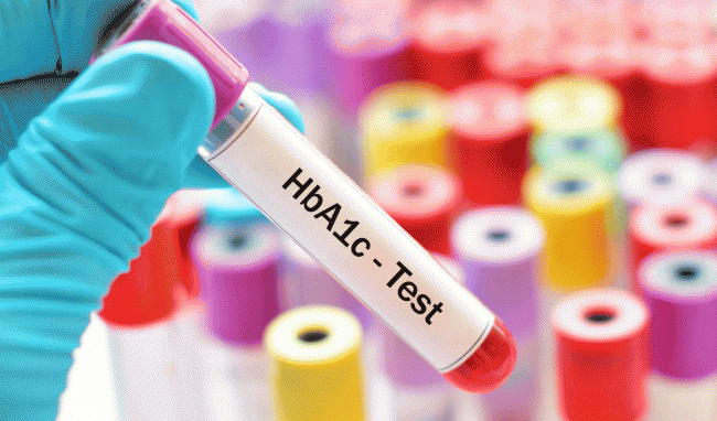 chỉ số HbA1c an toàn