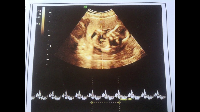 Mô hình phát triển của thai nhi từ 1 đến 7 tháng tuổi