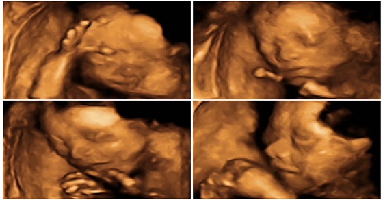 Siêu âm 4D giúp bạn thấy được cả giai đoạn phát triển của thai nhi trong bụng mẹ, mang lại trải nghiệm đầy cảm xúc và thú vị. Hãy xem những bức ảnh siêu âm 4D để thấy được con yêu của bạn đang phát triển như thế nào.