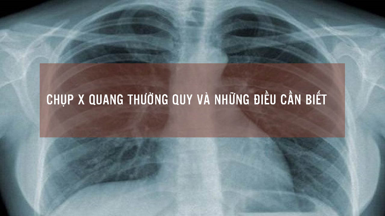 X quang thường quy và những điều cần biết